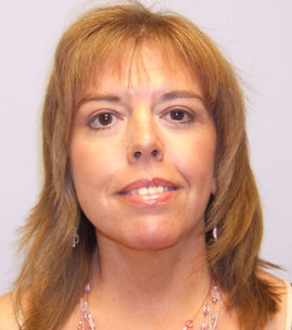 Facelift Before & After Image